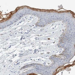 ALOX12B Antibody, Novus Biologicals 0.1mL; Unlabeled:Antibodies, Polyclonal